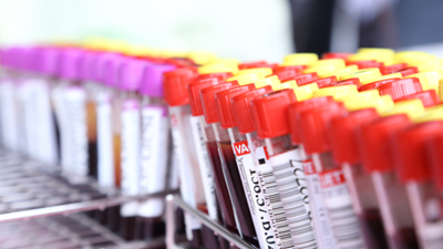 Blood-testing 'disruptor' charged with fraud