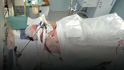 Overcoming oxygen supply issues