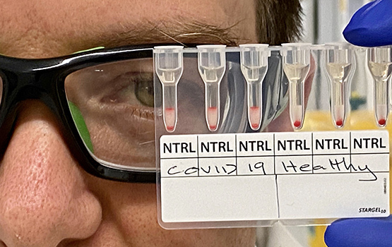 Covid-19 antibody test gives results in 20 minutes